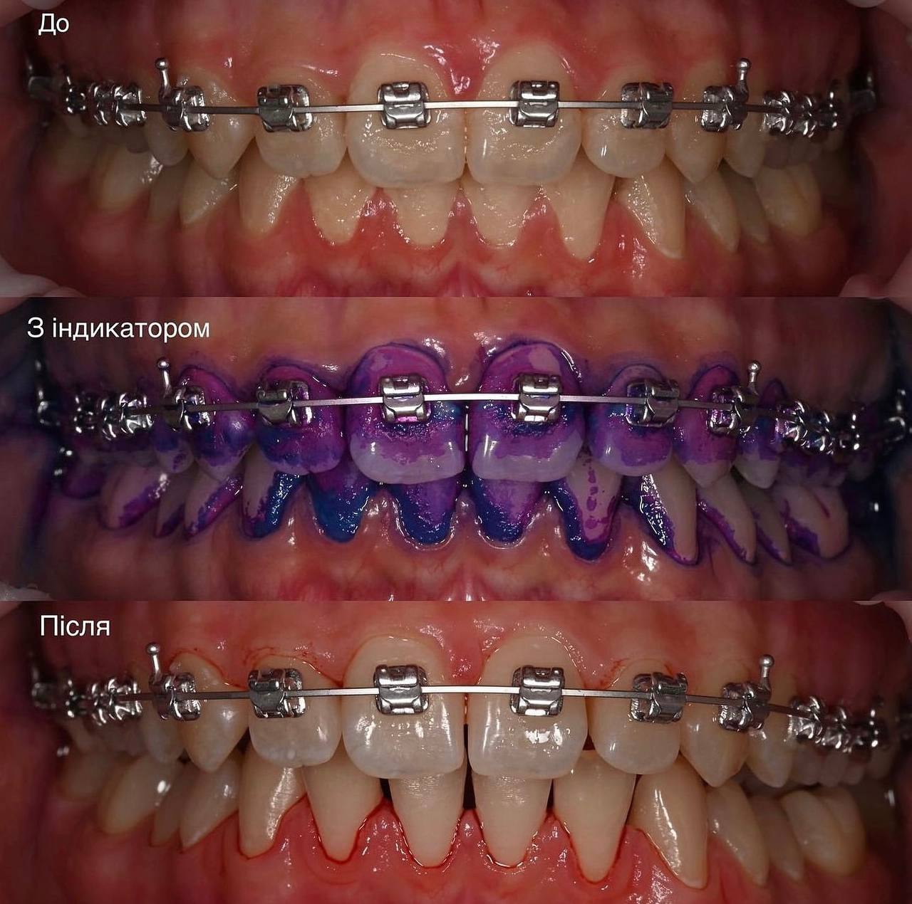 Професійна гігієна усіх рівнів складності