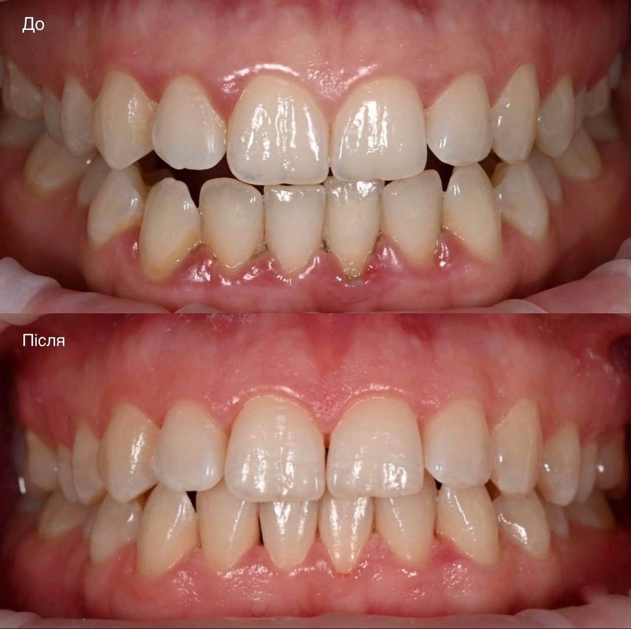 Пародонтологічне лікування